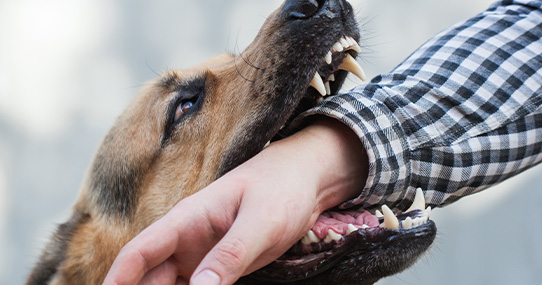 Dog Bites